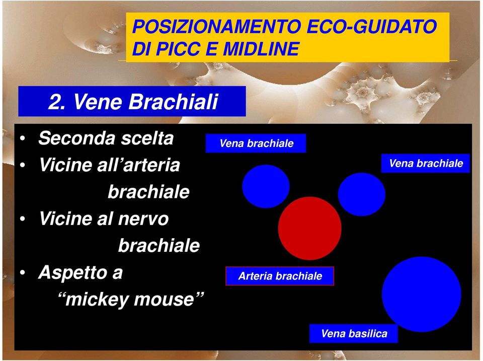 brachiale Aspetto a mickey mouse Vena