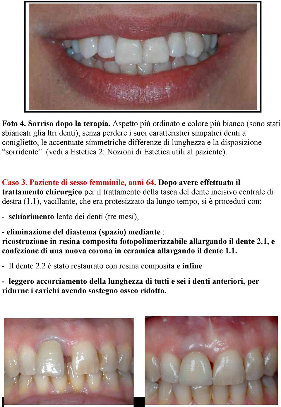 la disposizione sorridente (vedi a Estetica 2: Nozioni di Estetica utili al paziente). Caso 3. Paziente di sesso femminile, anni 64.