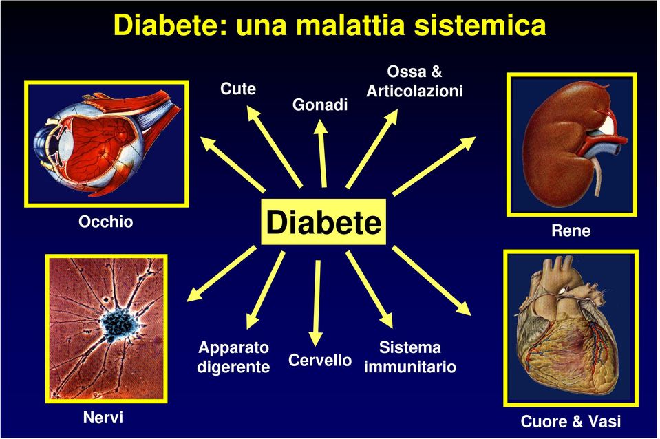 Diabete Rene Apparato digerente