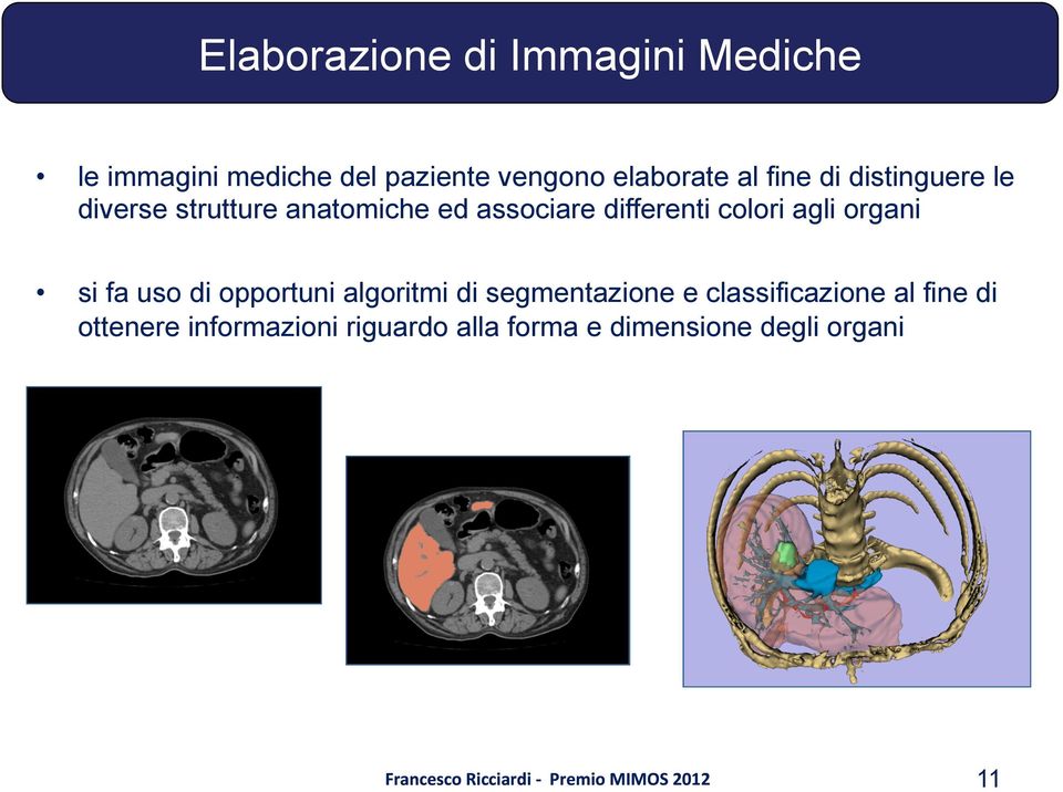 differenti colori agli organi si fa uso di opportuni algoritmi di segmentazione e