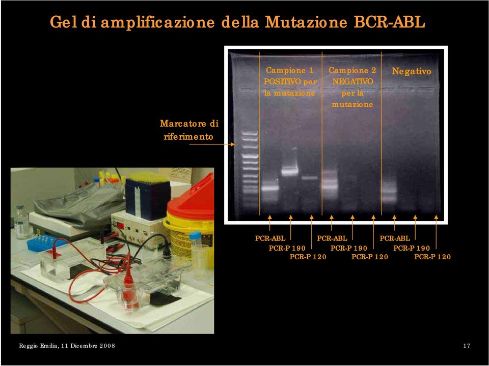 Marcatore di riferimento PCR-ABL PCR-P 190 PCR-P 120 PCR-ABL PCR-P