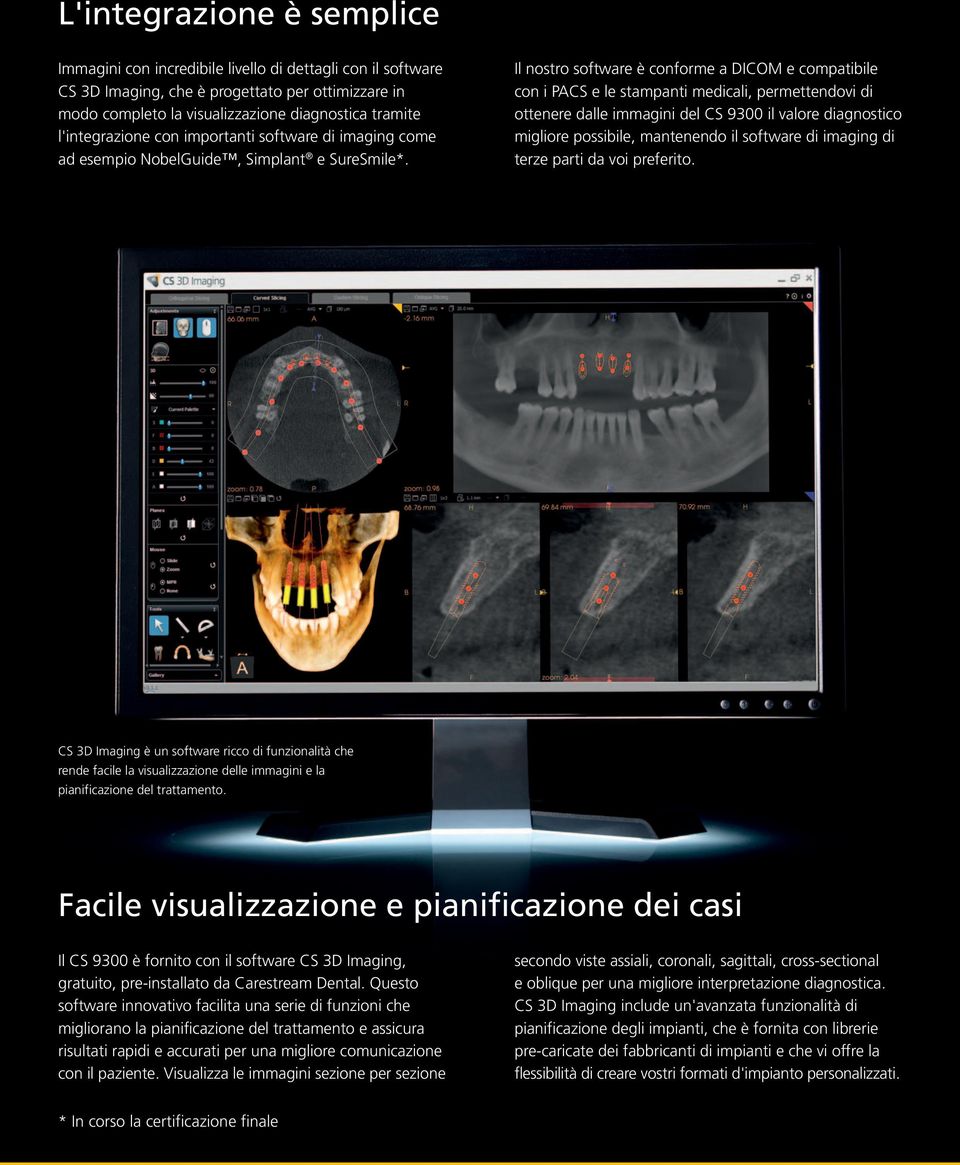 Il nostro software è conforme a DICOM e compatibile con i PACS e le stampanti medicali, permettendovi di ottenere dalle immagini del CS 9300 il valore diagnostico migliore possibile, mantenendo il