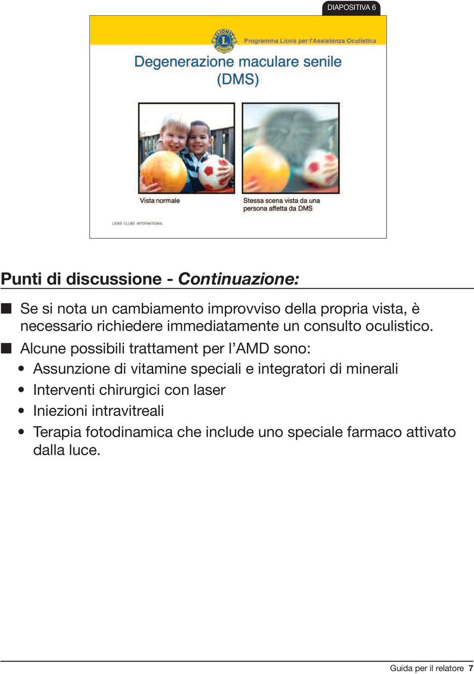 Alcune possibili trattament per l AMD sono: Assunzione di vitamine speciali e integratori di minerali