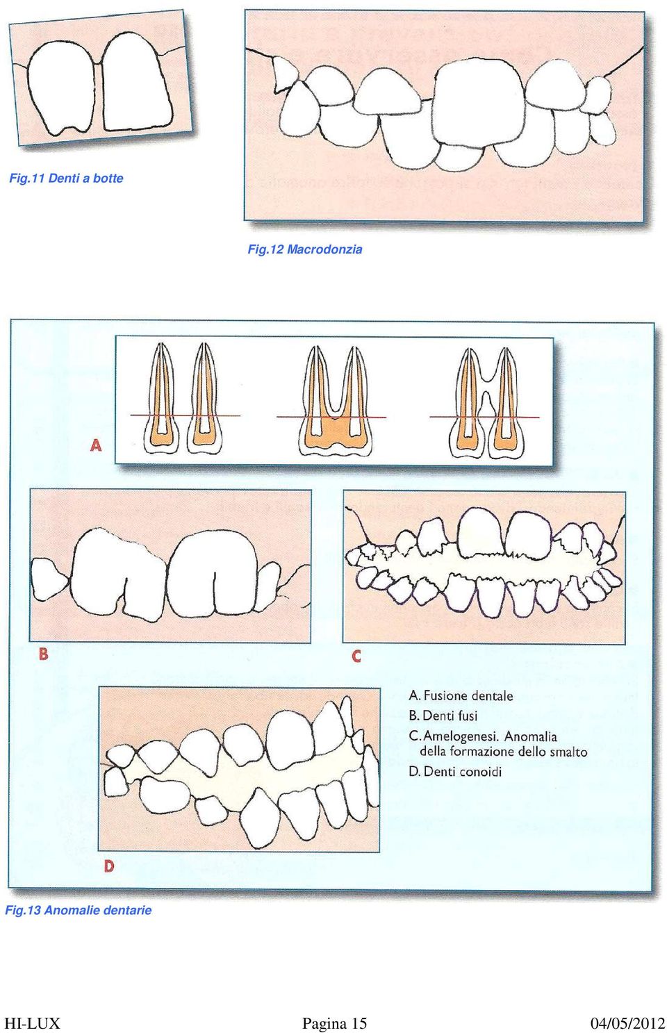 13 Anomalie dentarie