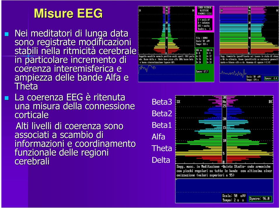 coerenza EEG è ritenuta una misura della connessione corticale Alti livelli di coerenza sono associati