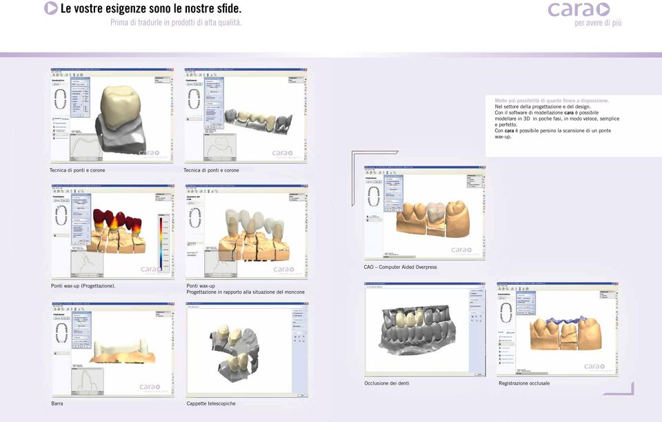 Con il software di modellazione cara è possibile modellare in 3D in poche fasi, in modo veloce, semplice e perfetto. Con cara è possibile persino la scansione di un ponte wax-up.