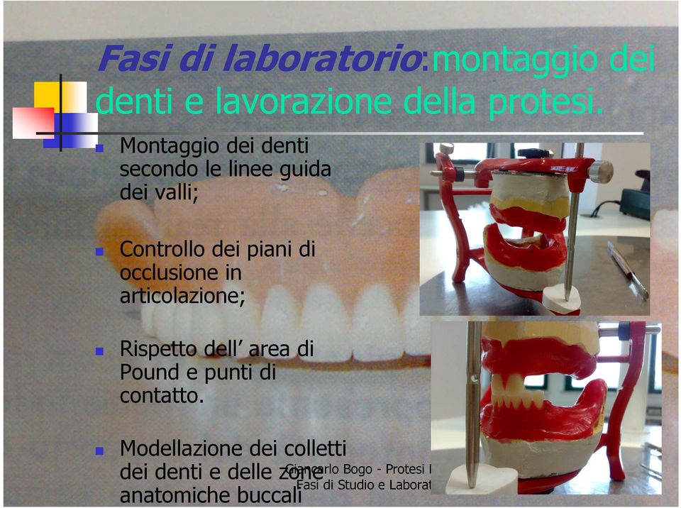 occlusione in articolazione; Rispetto dell area di Pound e punti di contatto.