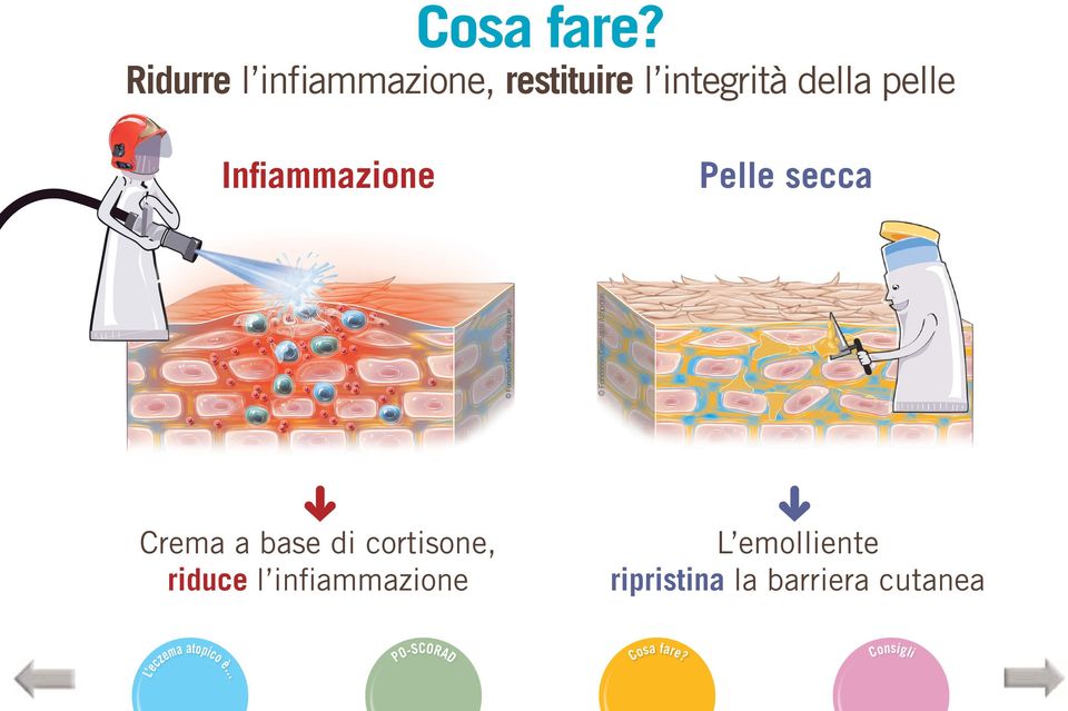 secca Crema a base di cortisone, riduce l