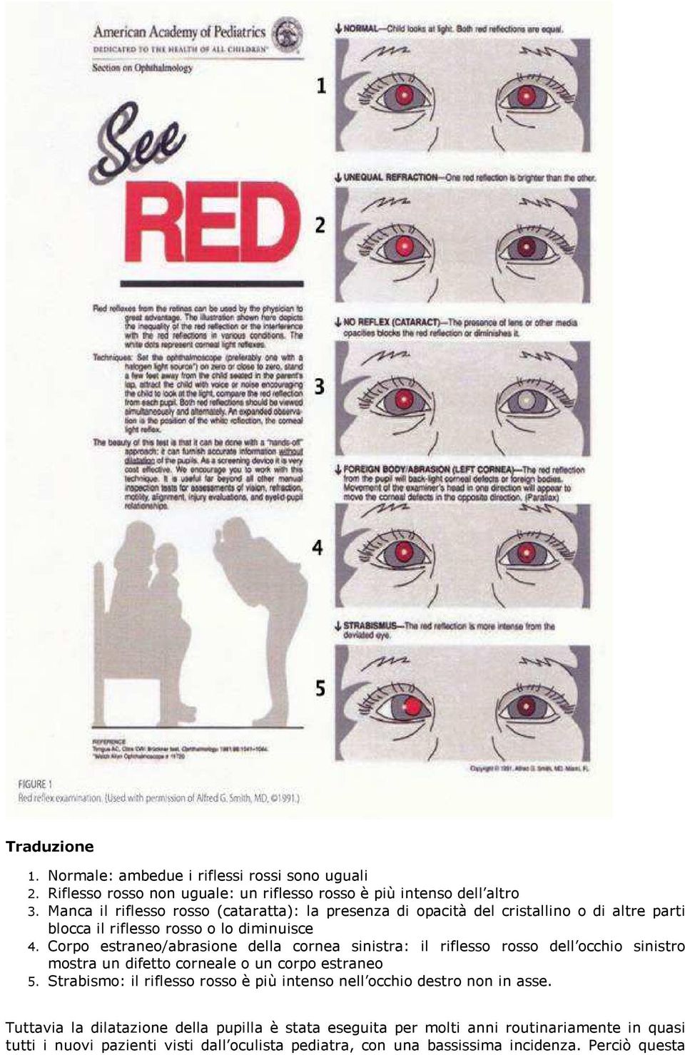 opacità del cristallino o di altre parti blocca il riflesso rosso o lo diminuisce Corpo estraneo/abrasione della cornea sinistra: il riflesso rosso dell occhio sinistro