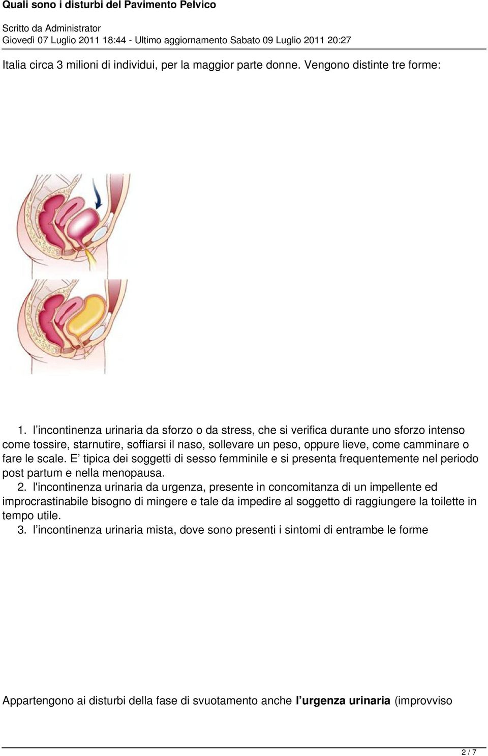 scale. E tipica dei soggetti di sesso femminile e si presenta frequentemente nel periodo post partum e nella menopausa. 2.