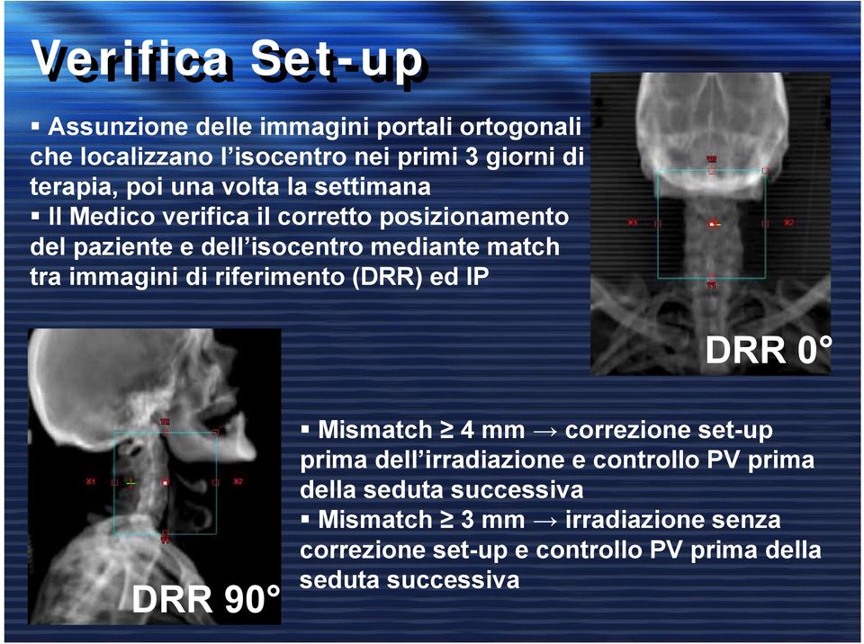 immagini di riferimento (DRR) ed IP DRR 0 DRR 90 Mismatch 4 mm correzione set-up prima dell irradiazione e controllo PV