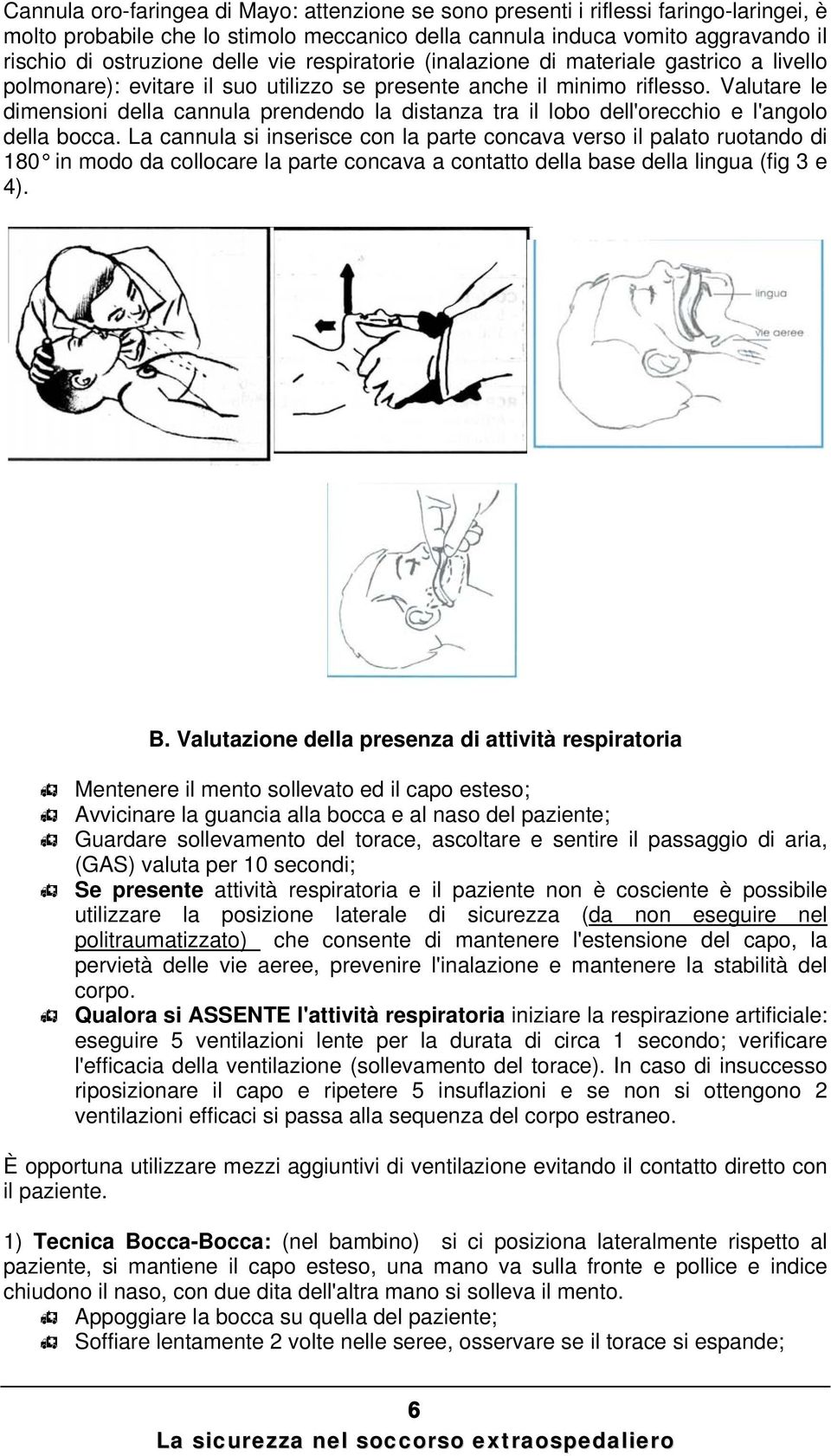 Valutare le dimensioni della cannula prendendo la distanza tra il lobo dell'orecchio e l'angolo della bocca.