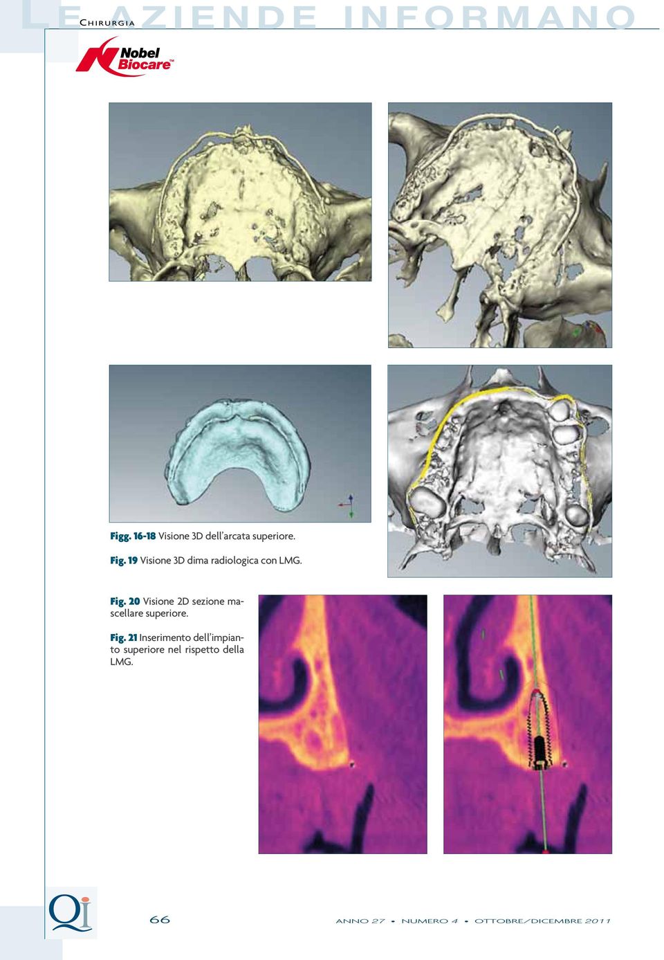 19 Visione 3D dima radiologica con LMG. Fig.