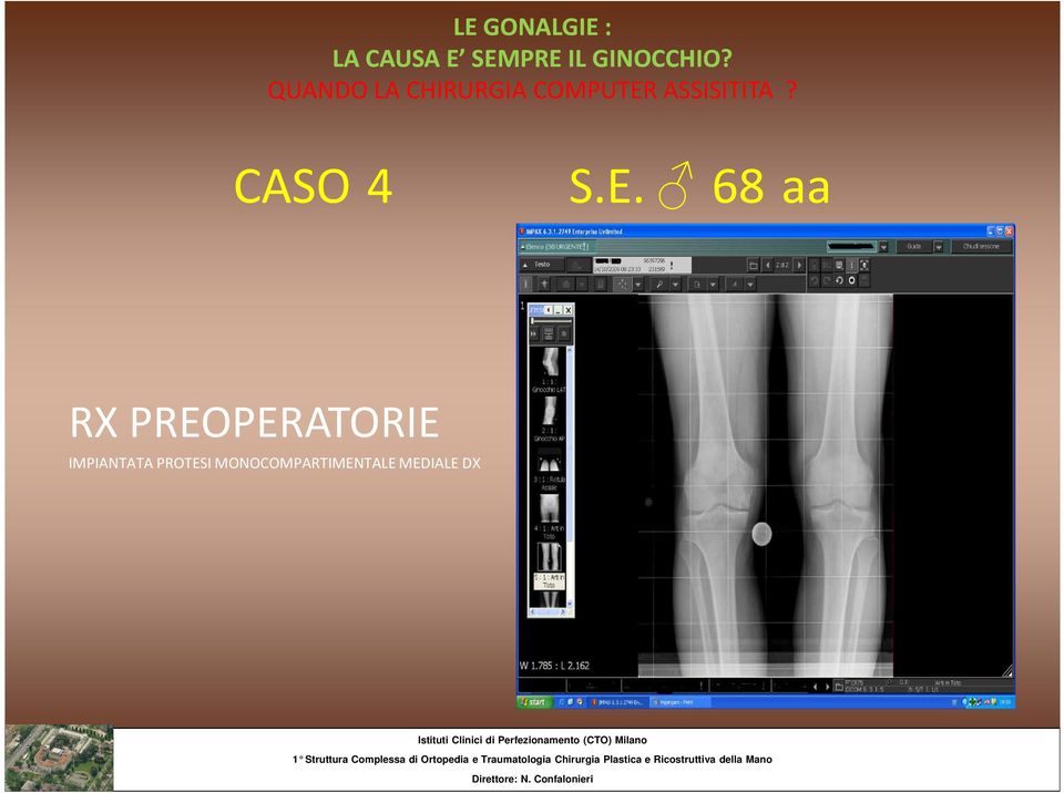 PREOPERATORIE