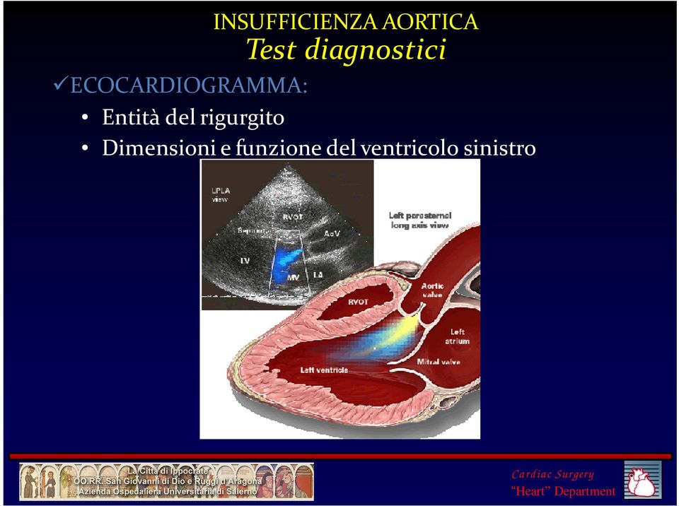 Entità del rigurgito