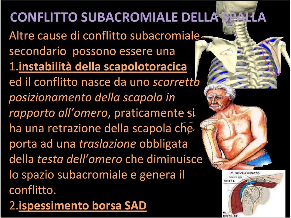 rapporto all omero,, praticamente si ha una retrazione della scapola che porta ad una traslazione obbligata