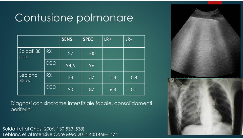 sindrome interstiziale focale, consolidamenti periferici Soldati et al