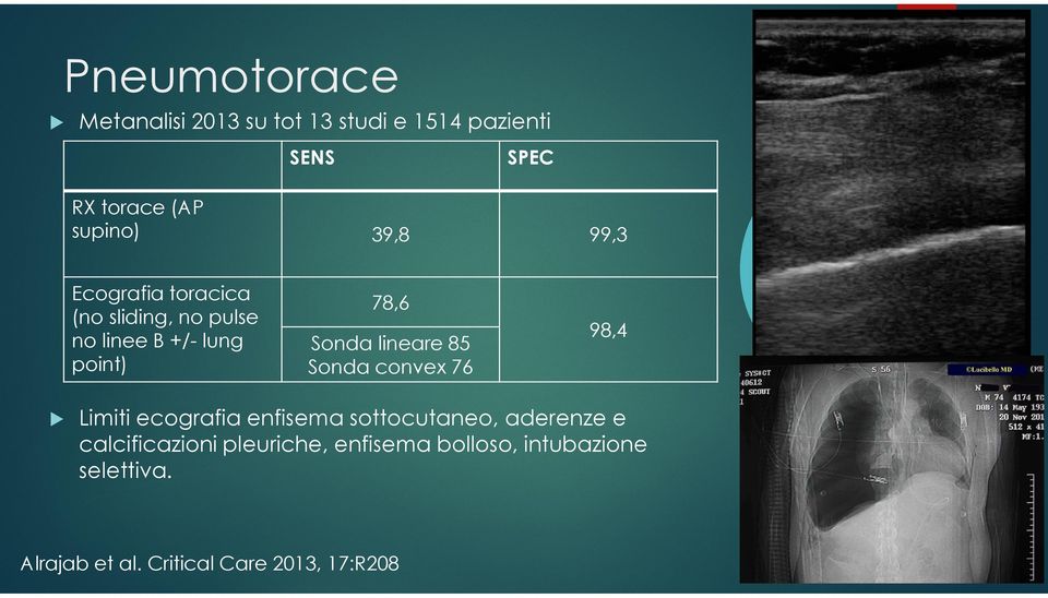 lineare 85 Sonda convex 76 98,4 Limiti ecografia enfisema sottocutaneo, aderenze e