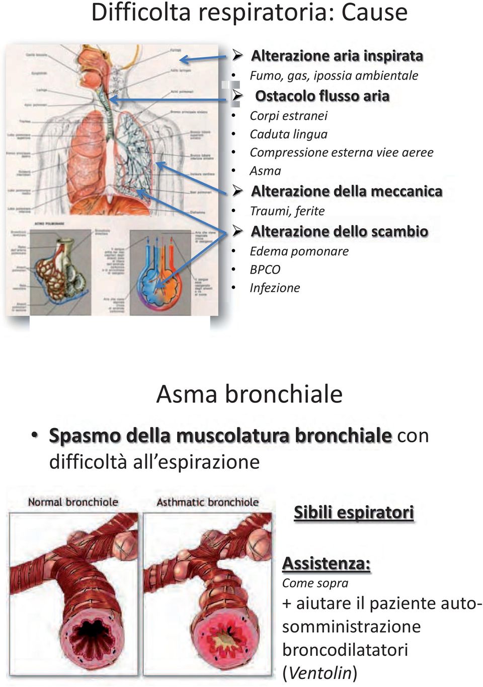 dello scambio Edema pomonare BPCO Infezione Asma bronchiale Spasmo della muscolatura bronchiale con difficoltà all