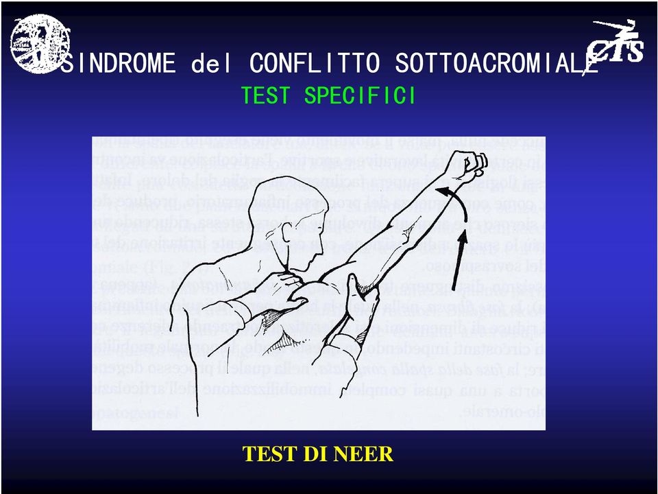 SOTTOACROMIALE