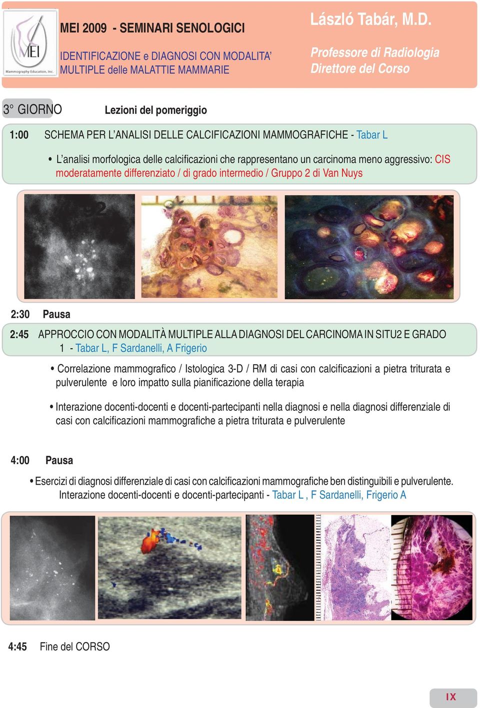 Frigerio Correlazione mammografi co / Istologica 3-D / RM di casi con calcifi cazioni a pietra triturata e pulverulente e loro impatto sulla pianifi cazione della terapia Interazione docenti-docenti