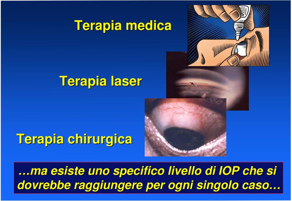 livello di IOP che si dovrebbe