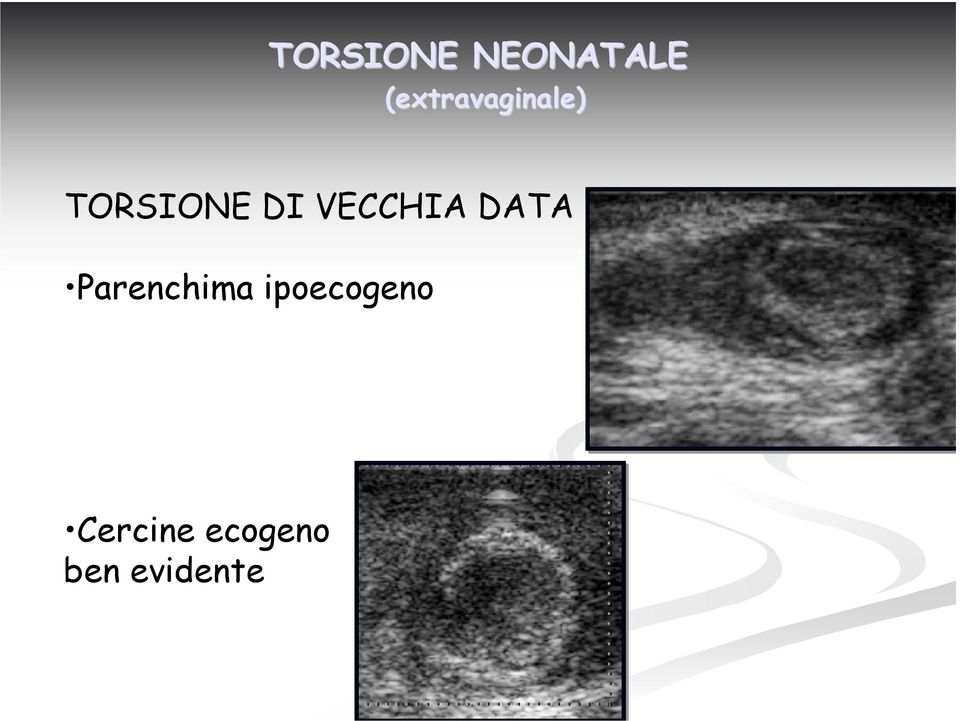 VECCHIA DATA Parenchima