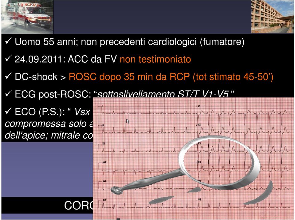 post-rosc: sottoslivellamento ST