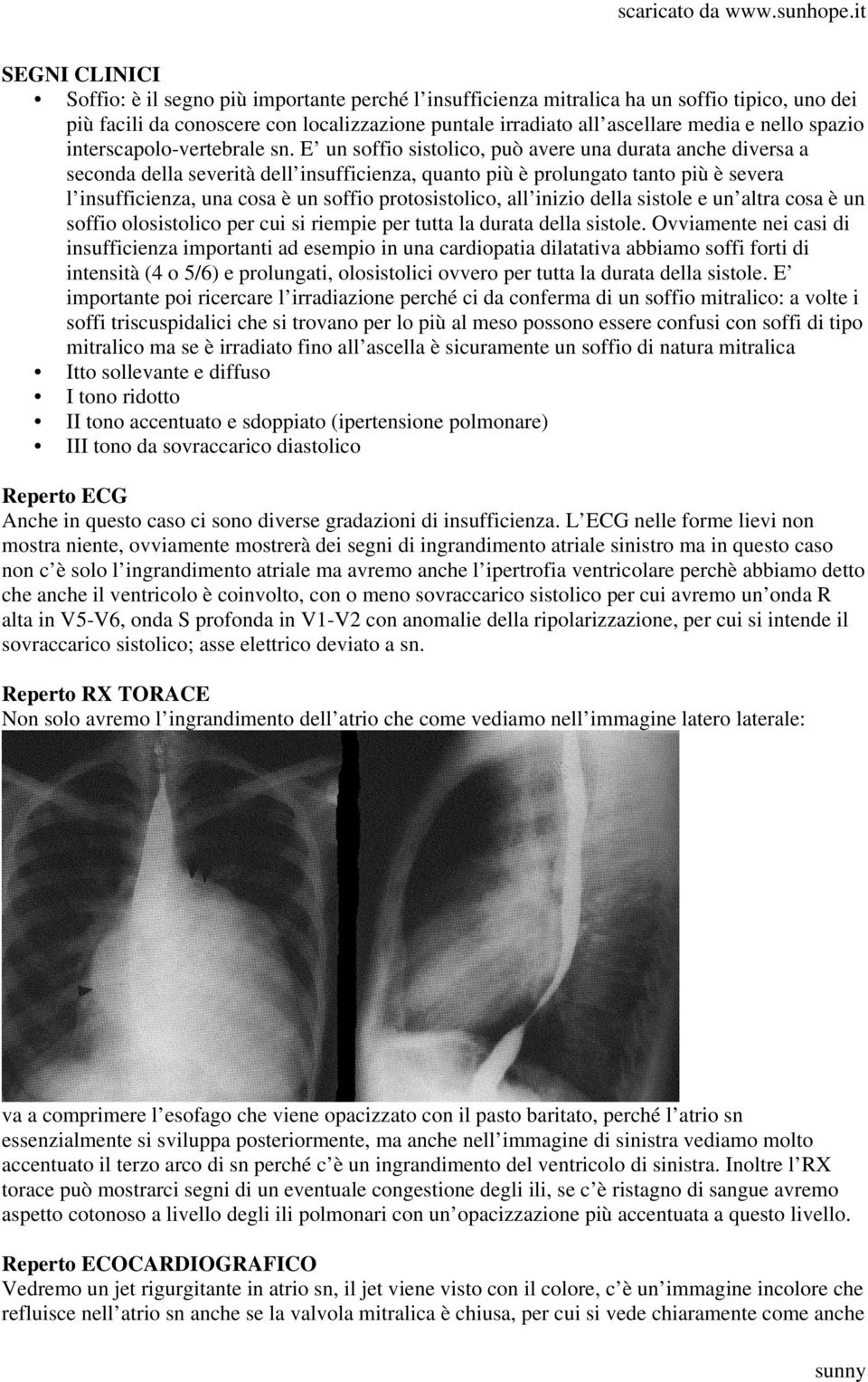 E un soffio sistolico, può avere una durata anche diversa a seconda della severità dell insufficienza, quanto più è prolungato tanto più è severa l insufficienza, una cosa è un soffio protosistolico,