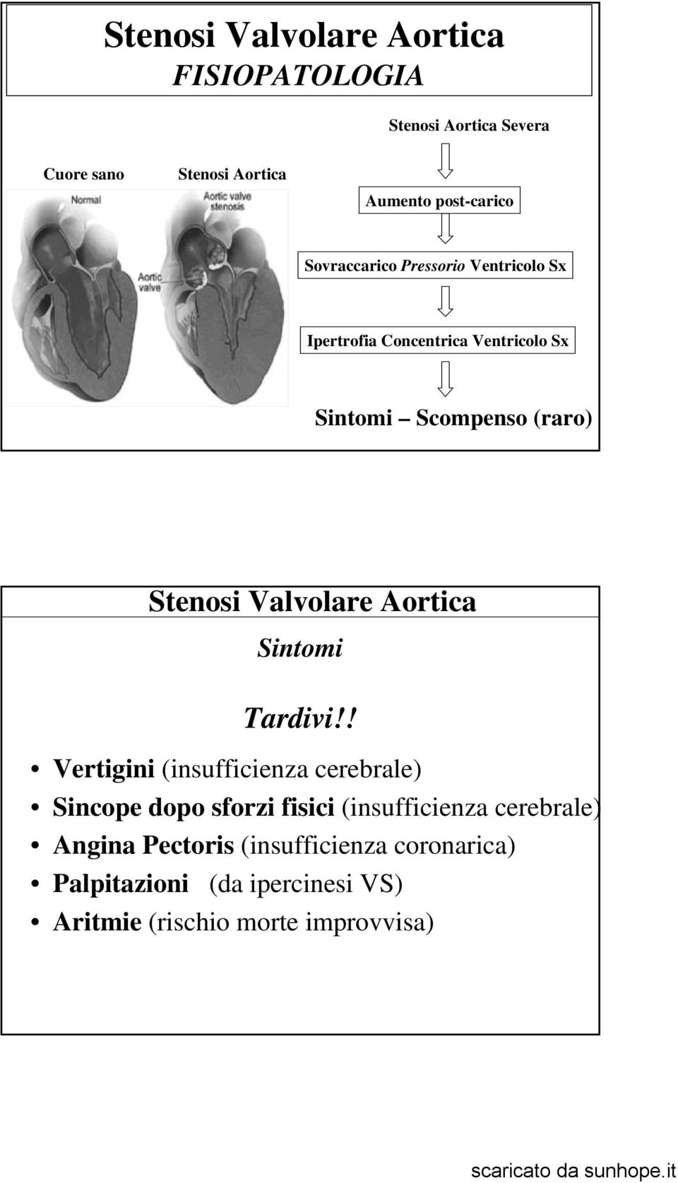 Valvolare Aortica Sintomi Tardivi!