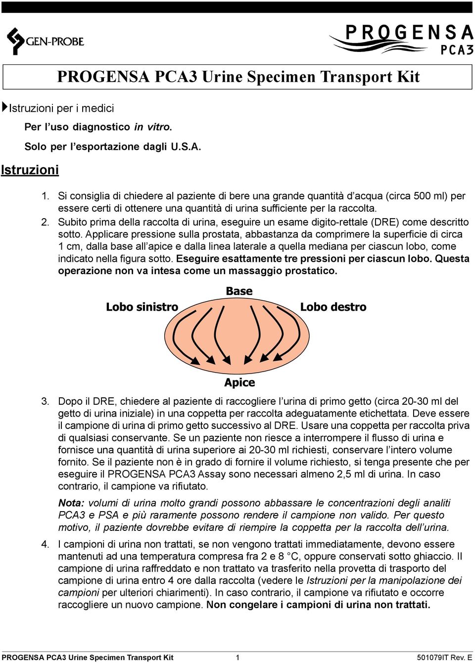 Subito prima della raccolta di urina, eseguire un esame digito-rettale (DRE) come descritto sotto.