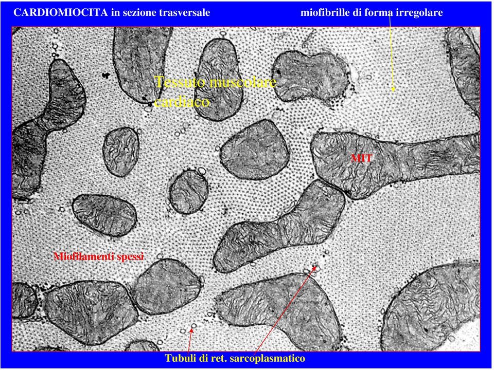 forma irregolare MIT