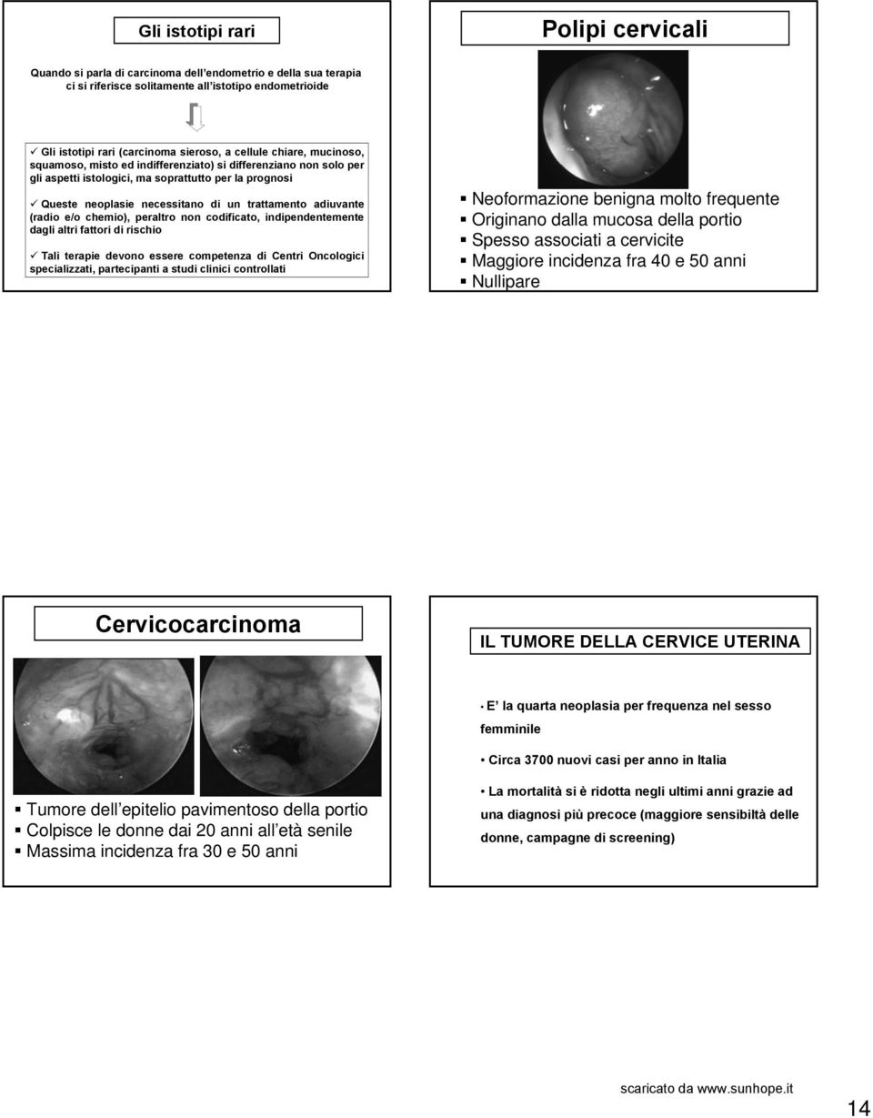 adiuvante (radio e/o chemio), peraltro non codificato, indipendentemente dagli altri fattori di rischio Tali terapie devono essere competenza di Centri Oncologici specializzati, partecipanti a studi