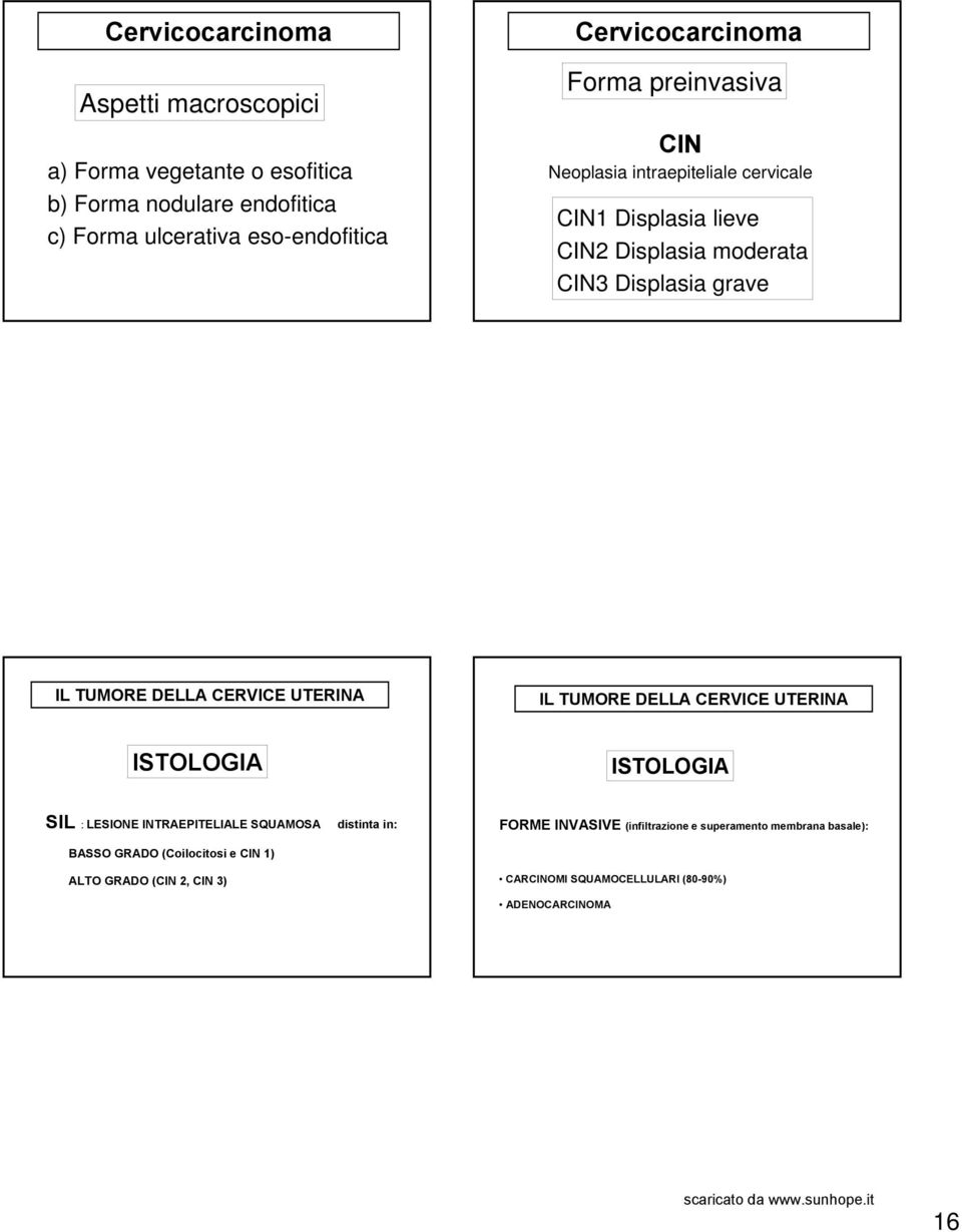 TUMORE DELLA CERVICE UTERINA IL TUMORE DELLA CERVICE UTERINA ISTOLOGIA ISTOLOGIA SIL : LESIONE INTRAEPITELIALE SQUAMOSA BASSO GRADO (Coilocitosi