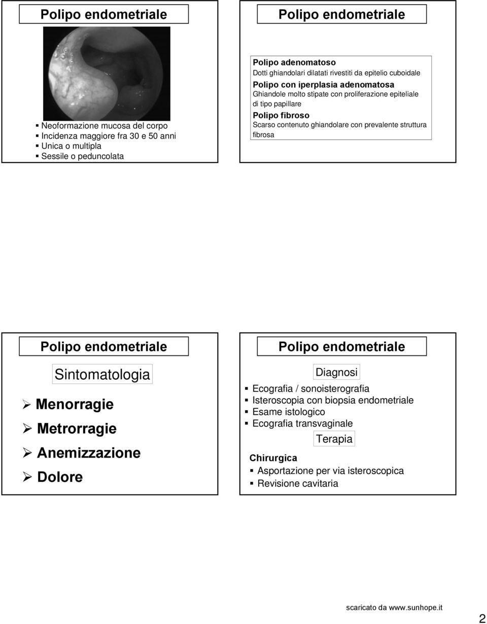 Scarso contenuto ghiandolare con prevalente struttura fibrosa Polipo endometriale Sintomatologia Menorragie Metrorragie Anemizzazione Dolore Polipo endometriale Diagnosi