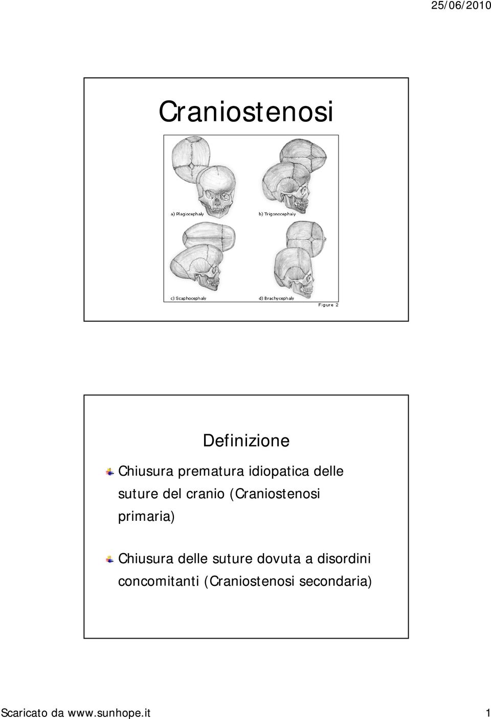 Chiusura delle suture dovuta a disordini