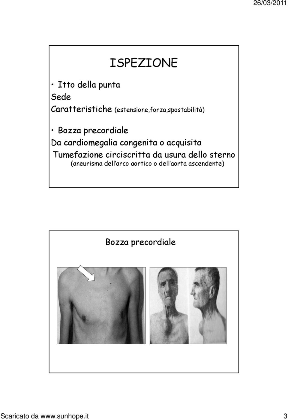 congenita o acquisita it Tumefazione circiscritta da usura dello sterno