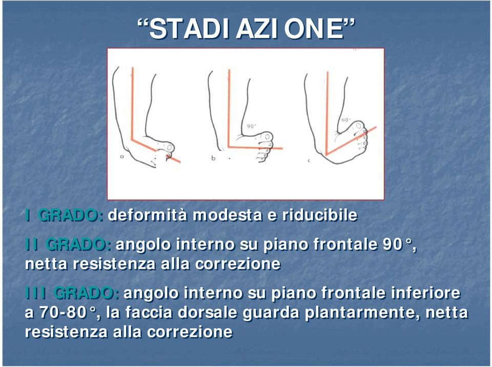 correzione III GRADO: angolo interno su piano frontale inferiore a