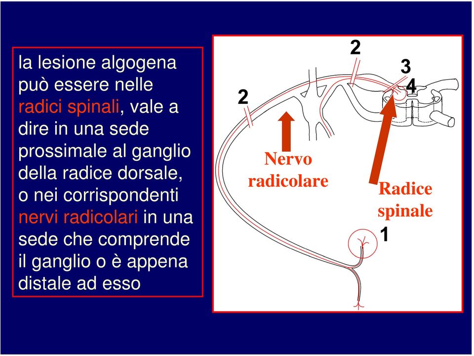 nei corrispondenti nervi radicolari in una sede che comprende