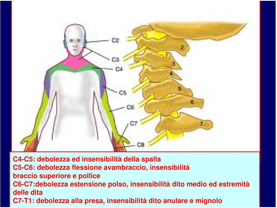 C6-C7:debolezza estensione polso, insensibilità dito medio ed