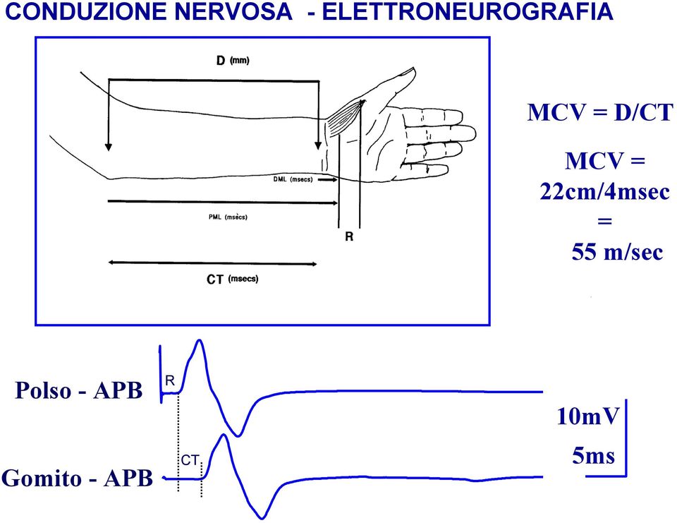 MCV = 22cm/4msec = 55 m/sec