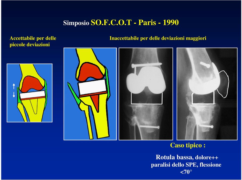 T - Paris - 1990 Accettabile per delle piccole