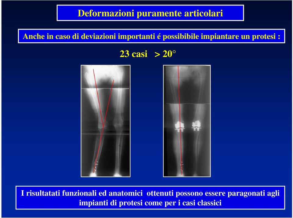 I risultatati funzionali ed anatomici ottenuti possono essere