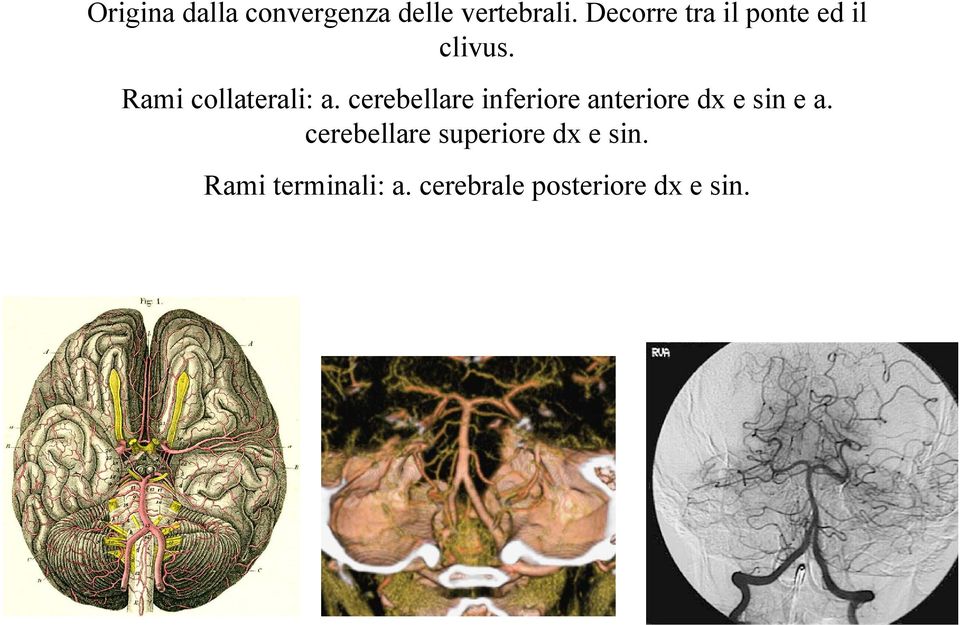cerebellare inferiore anteriore dx e sin e a.