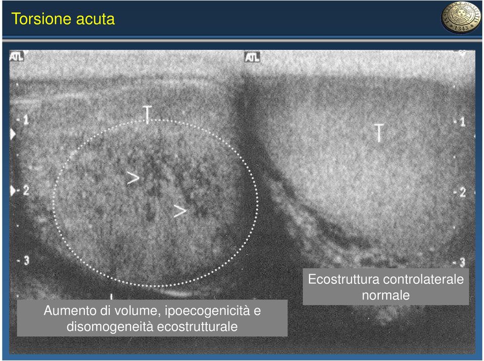 disomogeneità ecostrutturale