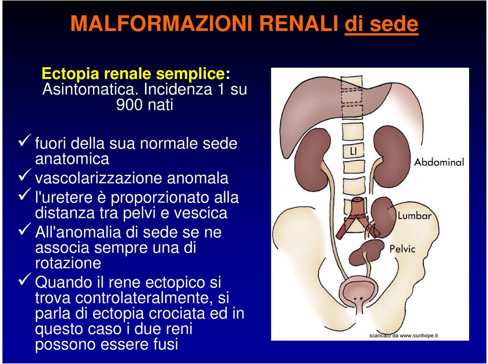 proporzionato alla distanza tra pelvi e vescica All'anomalia di sede se ne associa sempre una di