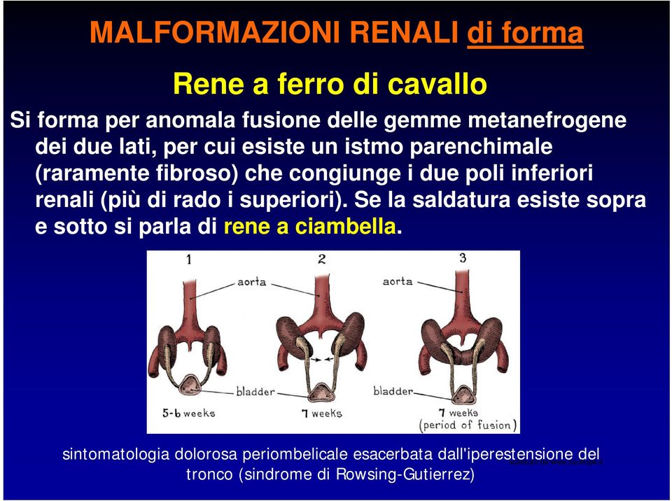 poli inferiori renali (più di rado i superiori).