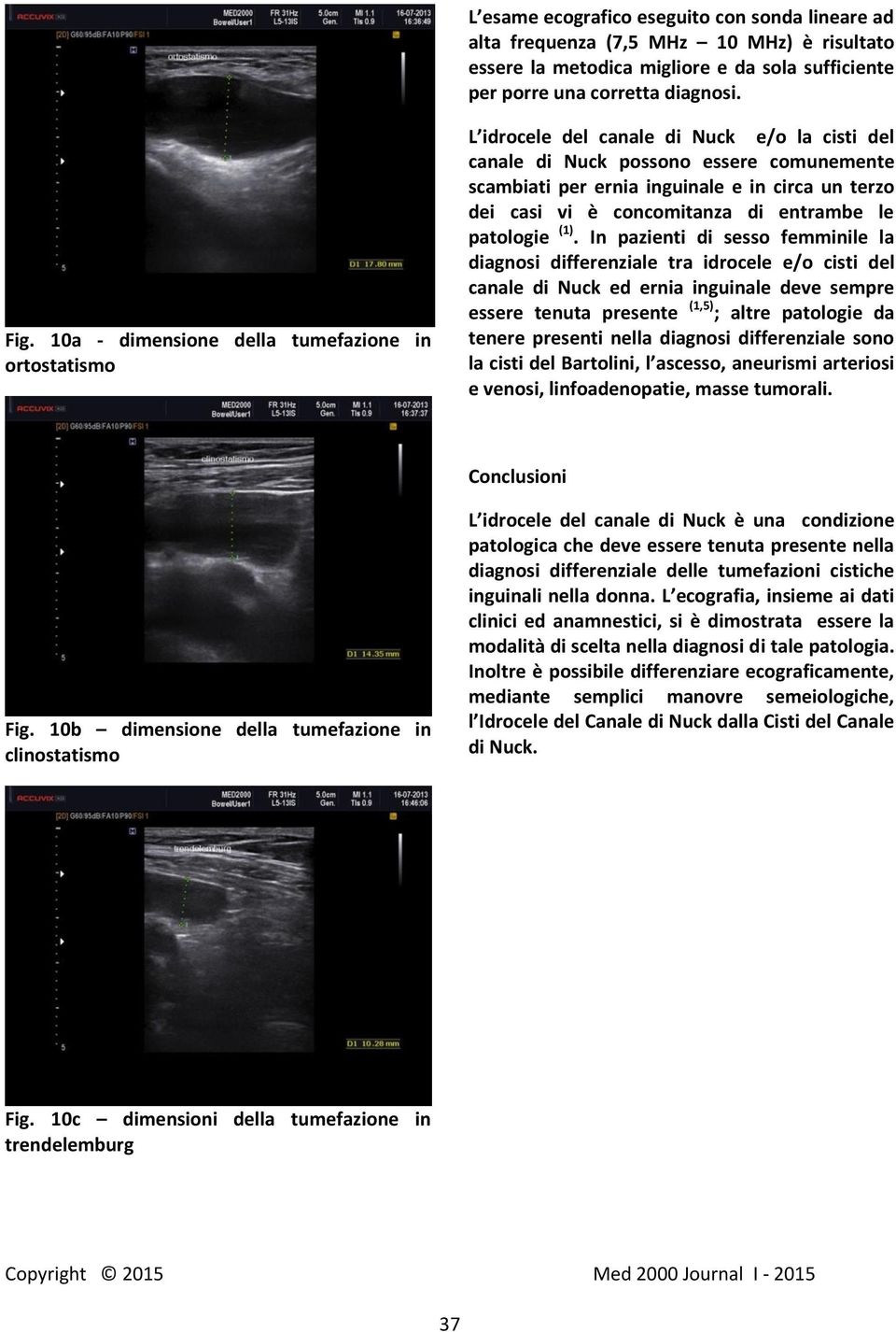 vi è concomitanza di entrambe le patologie (1).