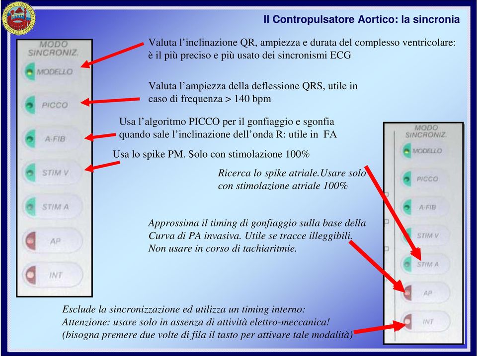 Solo con stimolazione 100% Ricerca lo spike atriale.usare solo con stimolazione atriale 100% Approssima il timing di gonfiaggio sulla base della Curva di PA invasiva. Utile se tracce illeggibili.