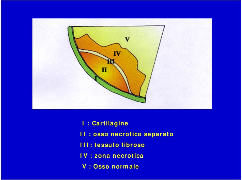 tessuto fibroso IV : zona